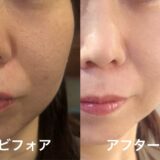 大人メイクレッスン！クレンジング、洗顔、スキンケアの美肌コース